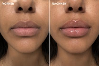 Aufpolsternder Lipgloss – Lips-Up™